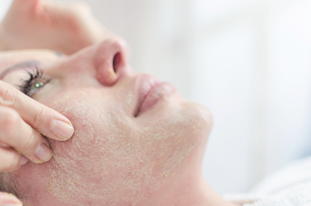 Limpeza de pele pré-peeling: como preparar a pele para melhores resultados | ADCOS Profissional